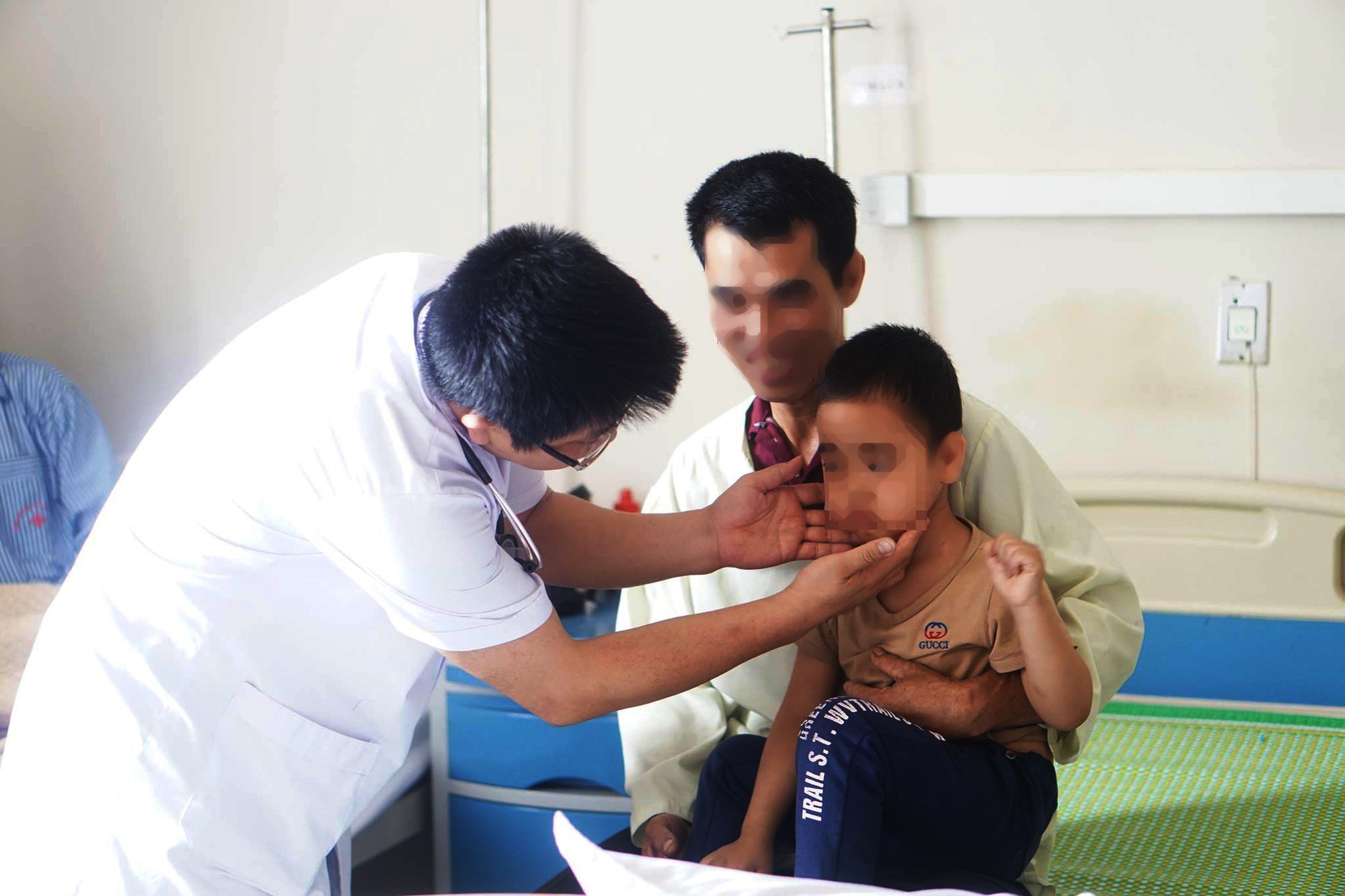 Bé trai 5 tuổi bỗng mọc lông rậm khắp mặt sau tiêm corticoid