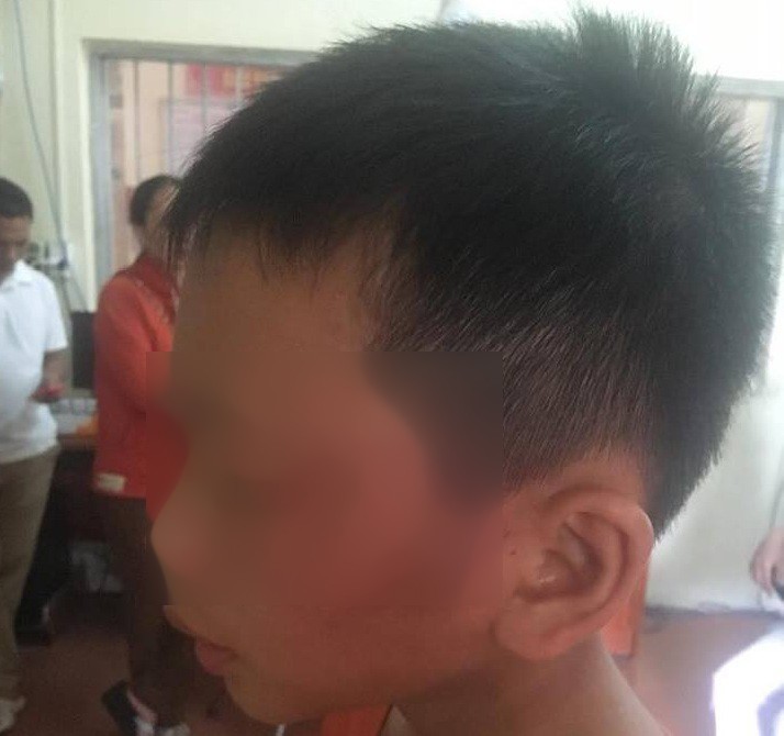 Nghi án nữ giáo viên bạo hành con riêng của chồng nhập viện