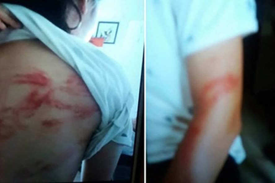 Người cha bị tố đánh con dã man: Cắn răng mà khóc vẫn vụt con 1 roi!