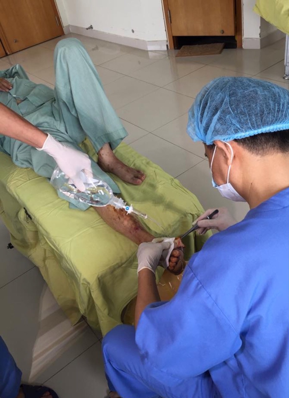 B&aacute;c sĩ r&ugrave;ng m&igrave;nh cứu b&agrave;n ch&acirc;n hoại tử do bệnh nh&acirc;n tự chữa đ&aacute;i th&aacute;o đường - Ảnh 1.
