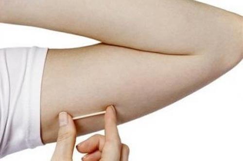 Có nên cấy thuốc tránh thai?