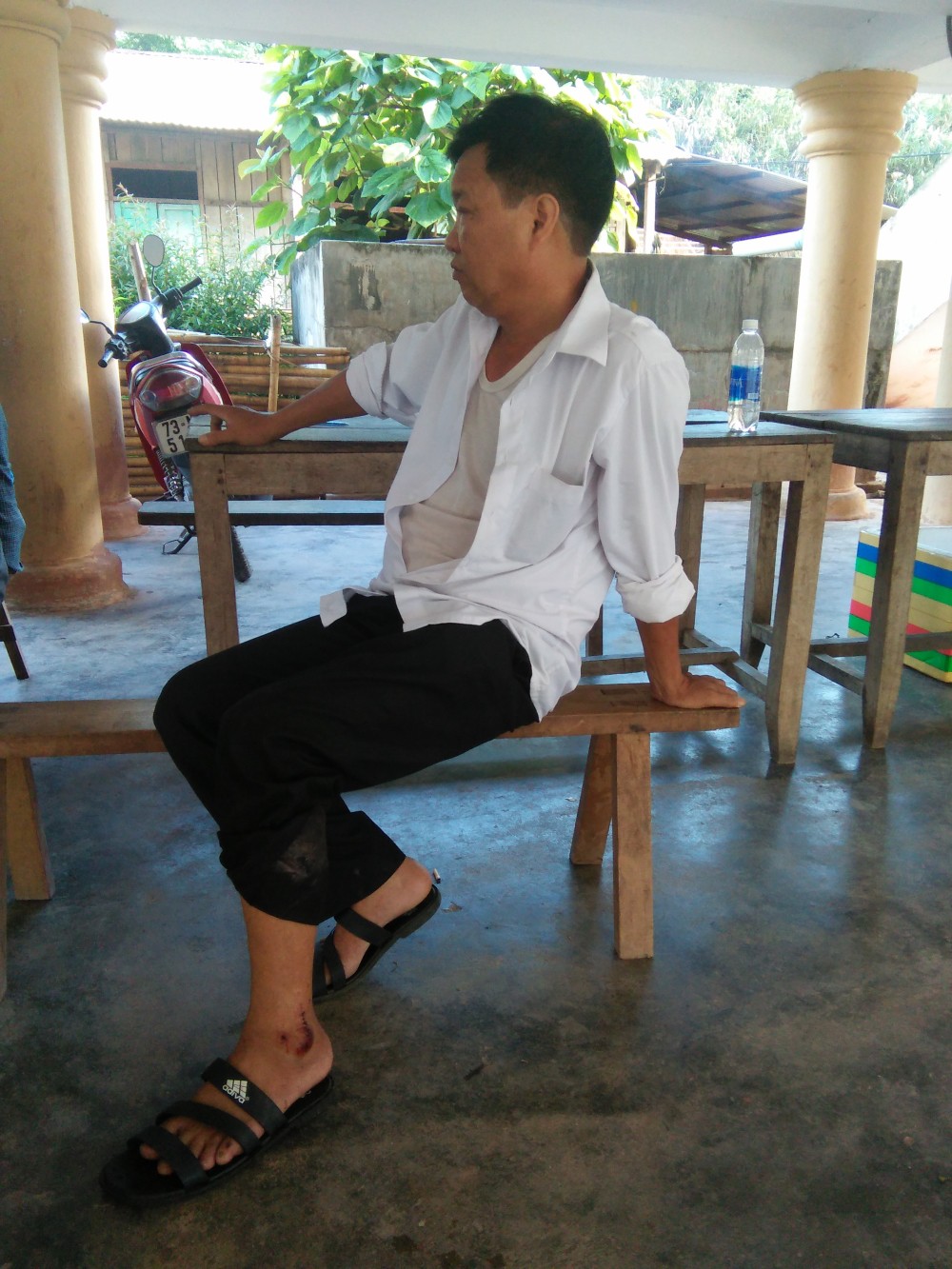 Khỉ đuôi lợn tấn công làm bị thương trung tá công an
