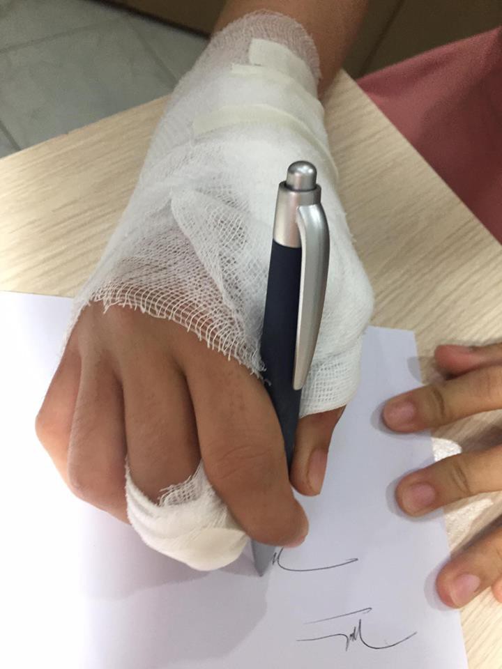 Căng thẳng cứu "sống" bàn tay bị xe tải cán qua