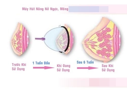 &ldquo;Tiền mất tật mang&rdquo; với những kiểu l&agrave;m đẹp tr&ecirc;n mạng - Ảnh 5.