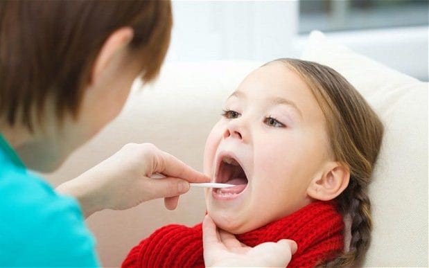 Cắt amidan: Tăng gấp 3 lần nguy cơ mắc cúm, suyễn, viêm phổi - Ảnh 1.