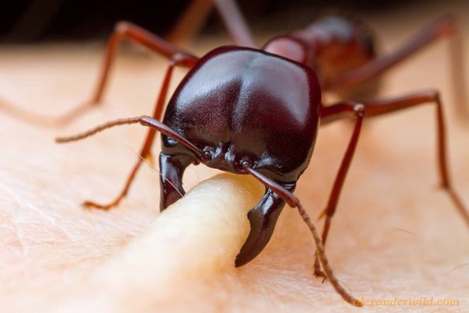 4 phương pháp chữa bệnh 'lấy độc trị độc'