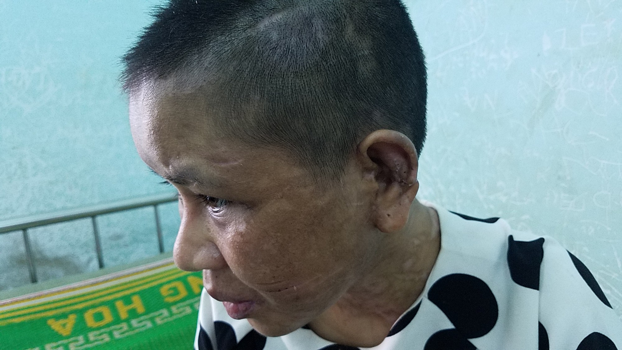 Vụ Nga "vọc" nghi tra tấn dã man người làm: Phường tưởng chỉ va chạm bình thường!