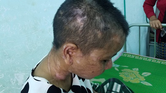 Điều tra, xử lý nghiêm vụ chủ bạo hành dã man người làm thuê
