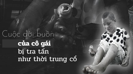 (eMagazine) - Cuộc đời buồn của cô gái bị tra tấn như thời trung cổ