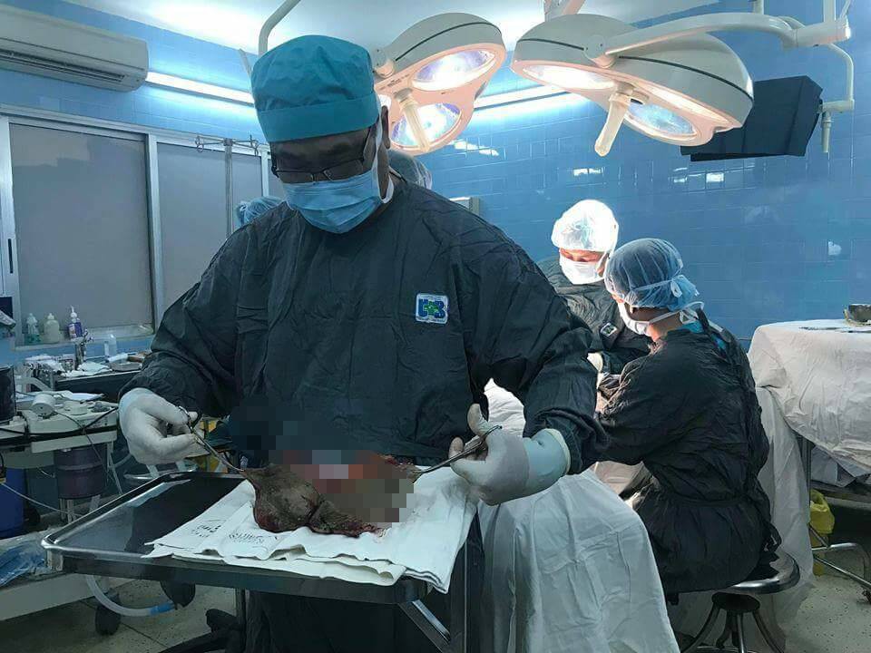 Đau khổ khi mang khối u vùng kín nặng 3 kg