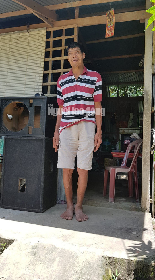 Cuộc sống khó khăn của người khổng lồ cao hơn 2,1 m ở miền Tây - Ảnh 3.