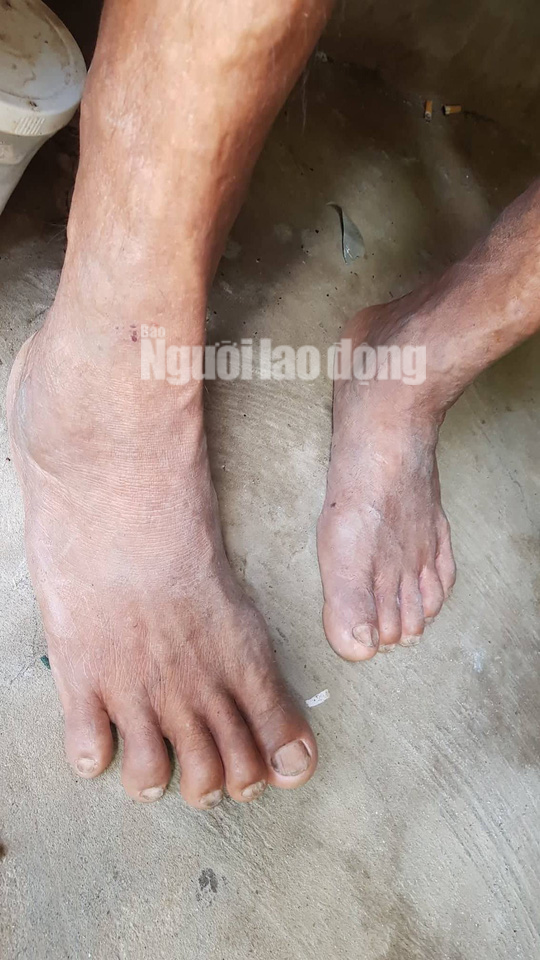 Cuộc sống khó khăn của người khổng lồ cao hơn 2,1 m ở miền Tây - Ảnh 5.