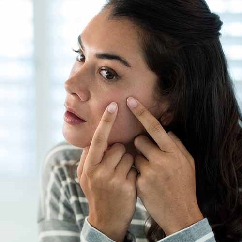 8 sai lầm cần tr&aacute;nh để c&oacute; l&agrave;n da sạch mụn - Ảnh 8.