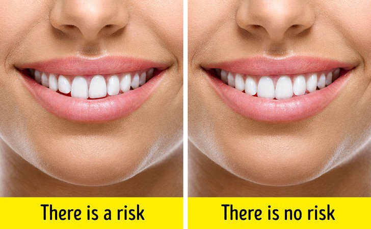 10 nguy&ecirc;n nh&acirc;n khiến da mặt bị chảy xệ sớm - Ảnh 8.