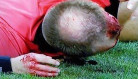 Trọng tài Europa League bị ném vỡ đầu, chảy máu bê bết