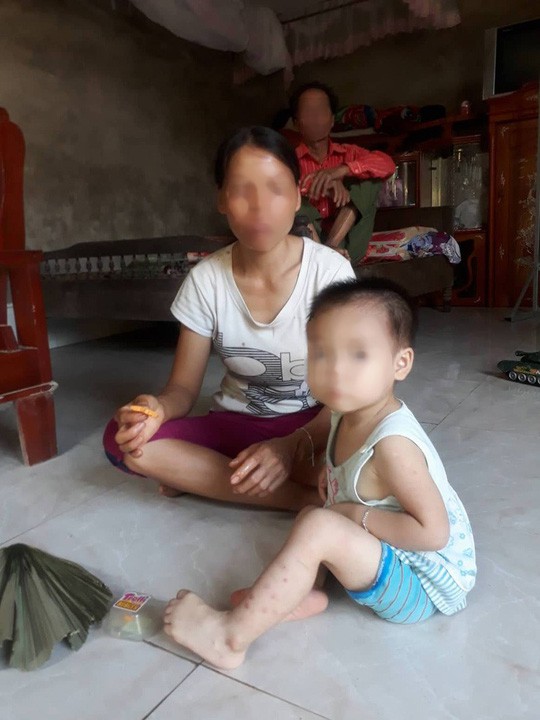 Vụ 42 người nhiễm HIV: H&eacute; lộ nguy&ecirc;n nh&acirc;n b&eacute; 18 th&aacute;ng tuổi nhiễm HIV - Ảnh 1.