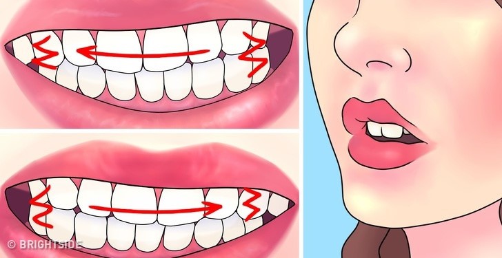 Mẹo chữa nghiến răng ban đ&ecirc;m - Ảnh 1.