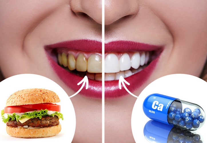 Mẹo chữa nghiến răng ban đêm