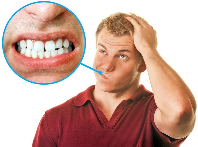 Mẹo chữa nghiến răng ban đ&ecirc;m - Ảnh 6.