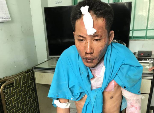 Đồng Nai: Bắt cha dượng đốt vợ và 2 con riêng của vợ