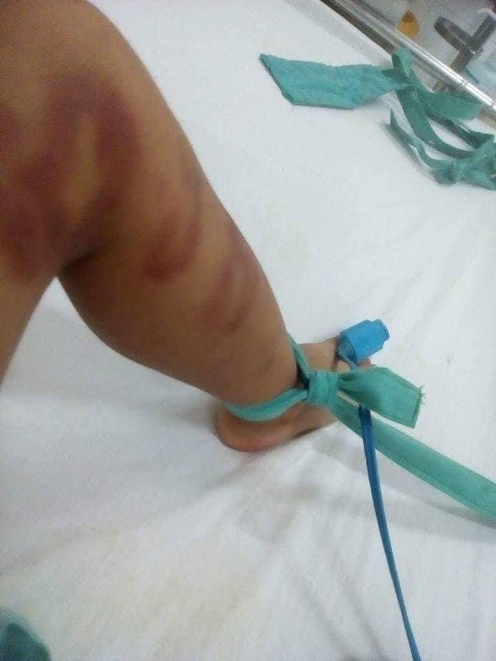 Bắt nghi phạm đánh đập con riêng của người tình nhập viện - Ảnh 2.