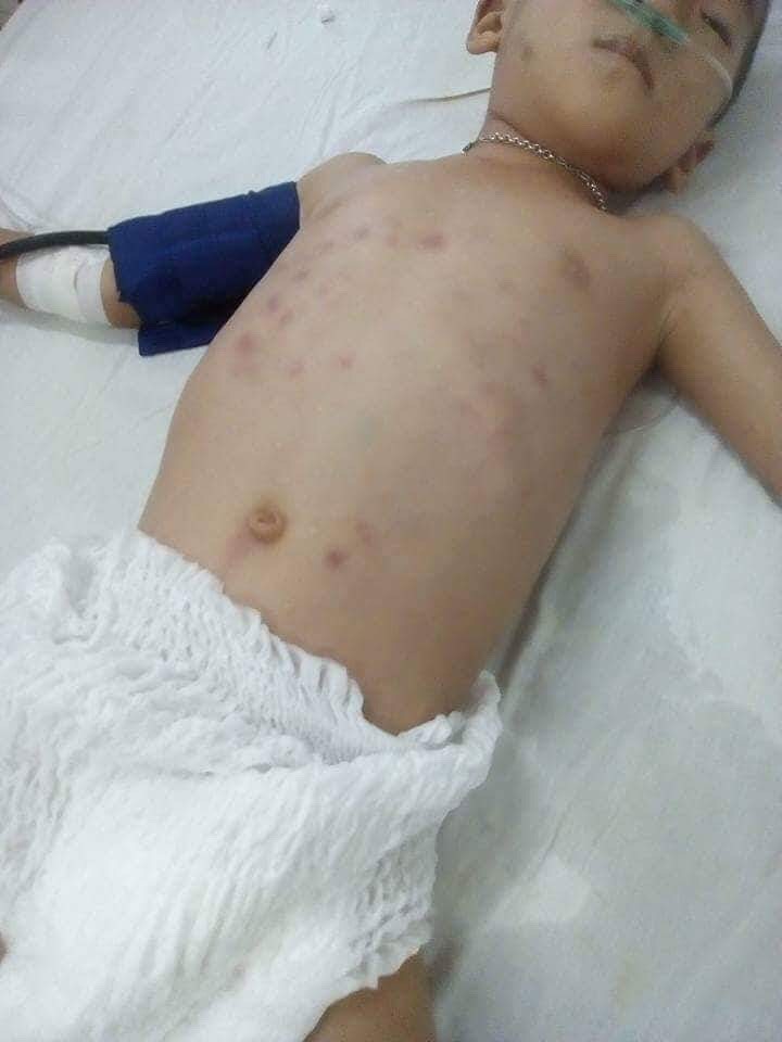 Bắt nghi phạm đánh đập con riêng của người tình nhập viện