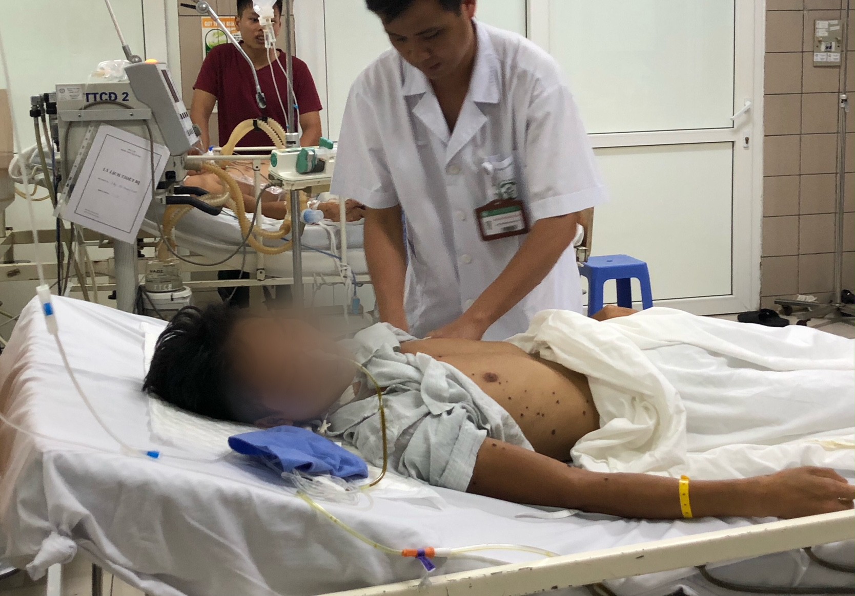 Bác sĩ "mách" cách xử trí đơn giản khi bị ong đốt