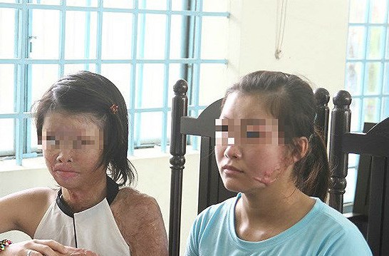 Khiếp đảm 1 cuộc chia tay bằng acid ở Cần Thơ