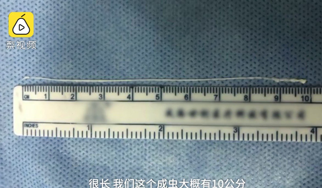Trung Quốc: S&aacute;n d&acirc;y d&agrave;i 10 cm chui v&agrave;o n&atilde;o thanh ni&ecirc;n m&ecirc; đồ nướng - Ảnh 2.
