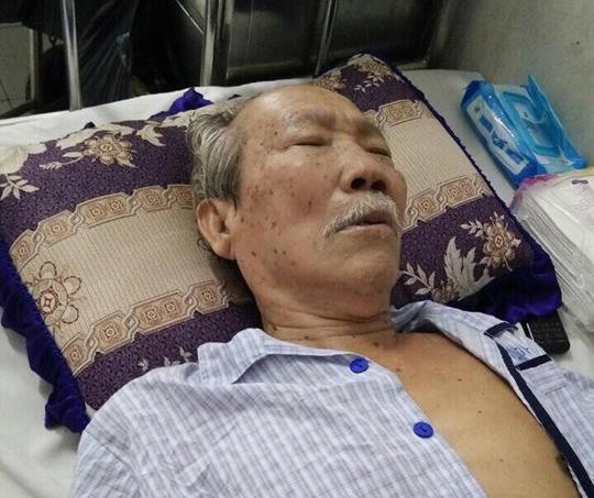 Soạn giả Nguyên Thảo cấp cứu vì ung thư ruột