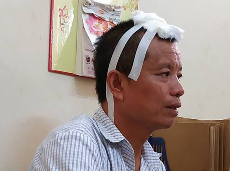 Sẽ giám định tâm thần với nghi phạm gây thảm sát kinh hoàng 3 người chết