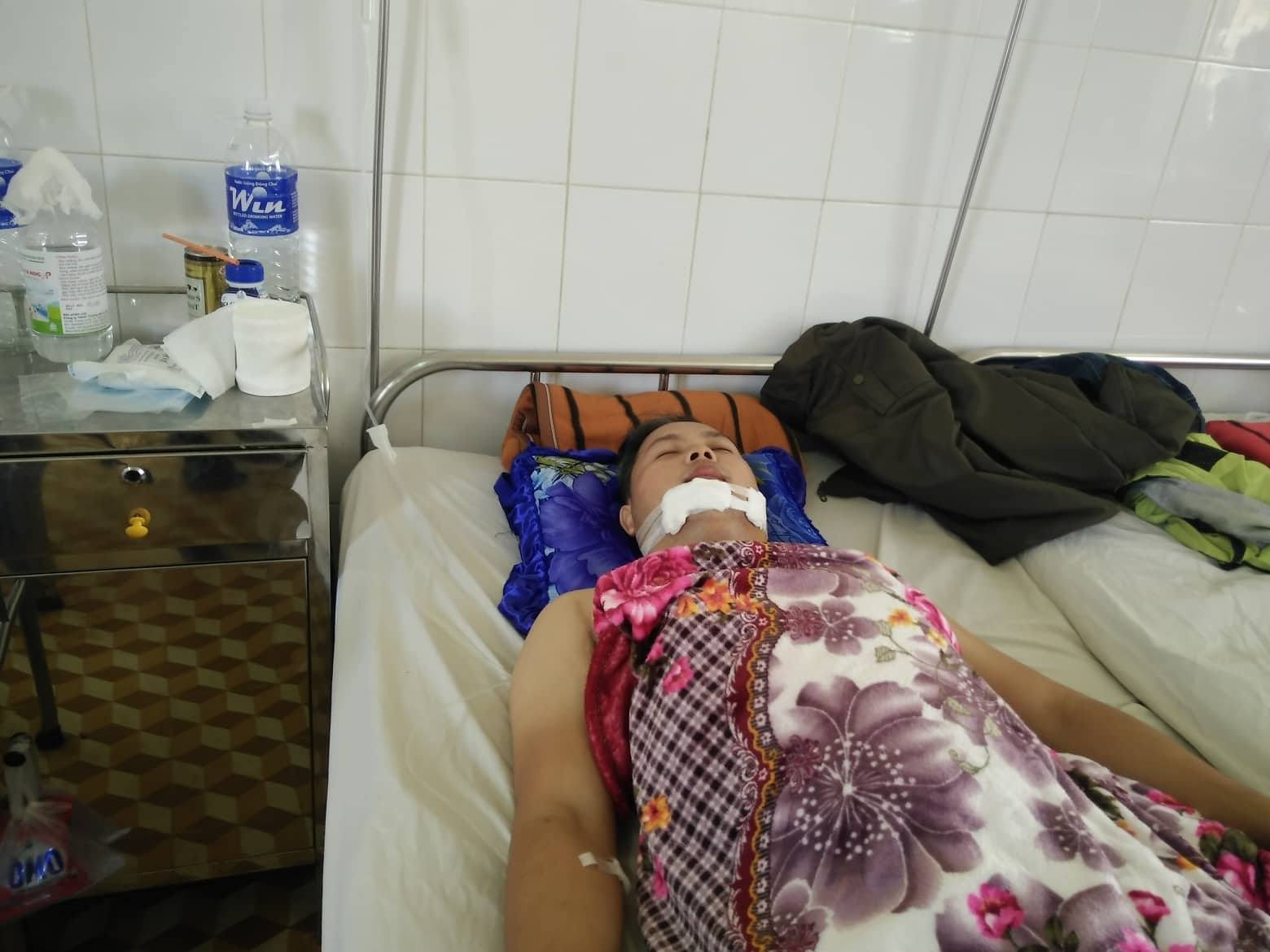 Tên trộm lái xe máy tông 1 công an bị thương