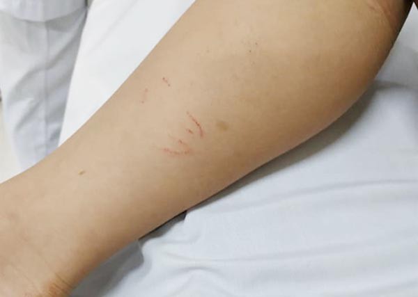 Kỹ năng sơ cứu khi bị rắn độc cắn ai cũng cần thuộc lòng - Ảnh 2.