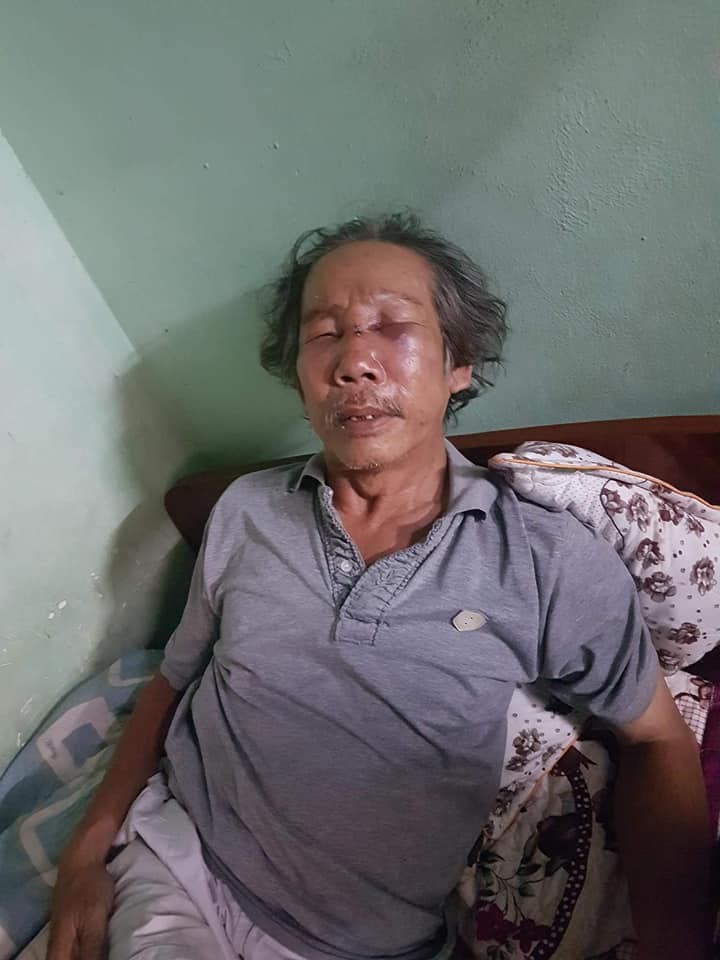 Bắt được bảo vệ chung cư h&agrave;nh hung d&atilde; man cụ &ocirc;ng - Ảnh 2.