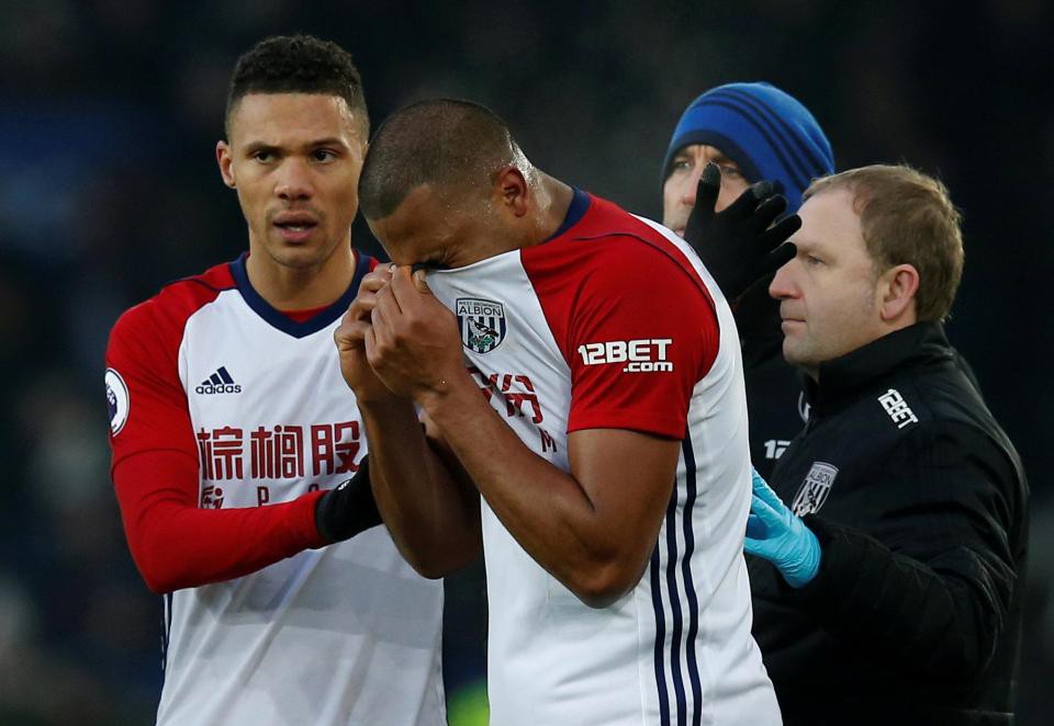 Tiền đạo West Brom s&uacute;t g&atilde;y ch&acirc;n đối thủ - Ảnh 8.
