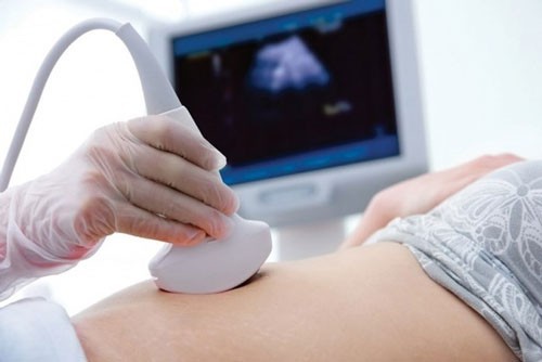 Thai 20 tuần nhưng siêu âm tới 4 lần, có sao không?