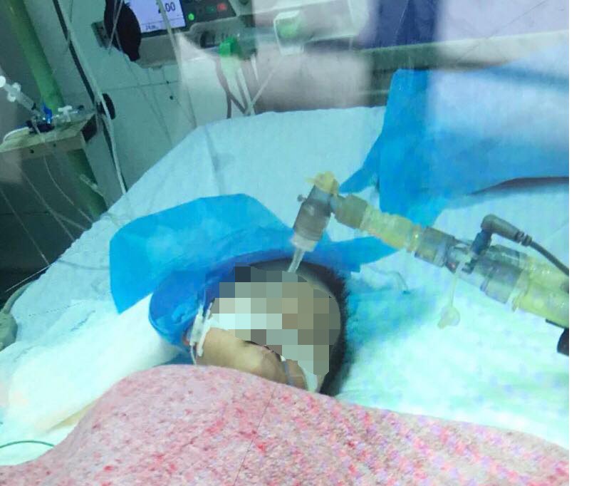 Bé gái 8 tháng tuổi nguy kịch vì điều dưỡng tiêm nhầm thuốc uống