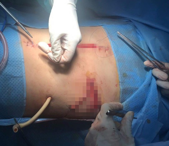 Ngoạn mục ca TNGT tưởng chừng khó sống