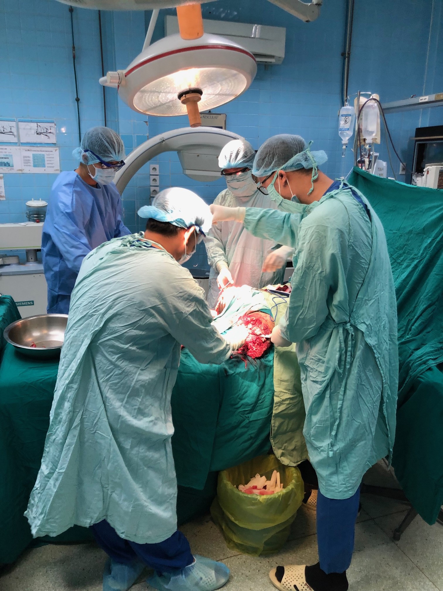 Anh công nhân vào viện kèm 2 chân bị đứt rời