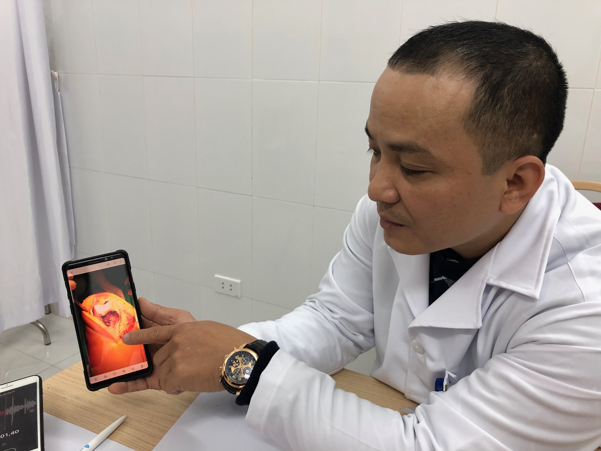 Ghép xương từ người hiến chết não cứu chân bệnh nhân bị u tế bào khổng lồ