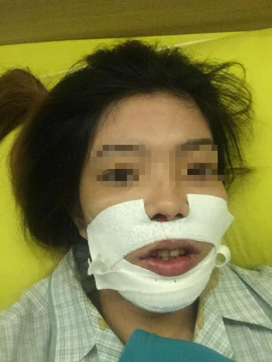 Mở băng sau cắt hàm, nữ công nhân không tin vào gương mặt mình - Ảnh 2.