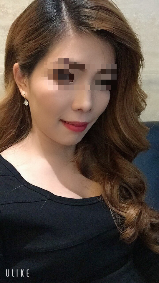 Mở băng sau cắt hàm, nữ công nhân không tin vào gương mặt mình - Ảnh 3.