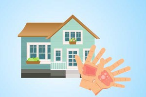 Cha mẹ cần làm gì khi con bị bỏng?
