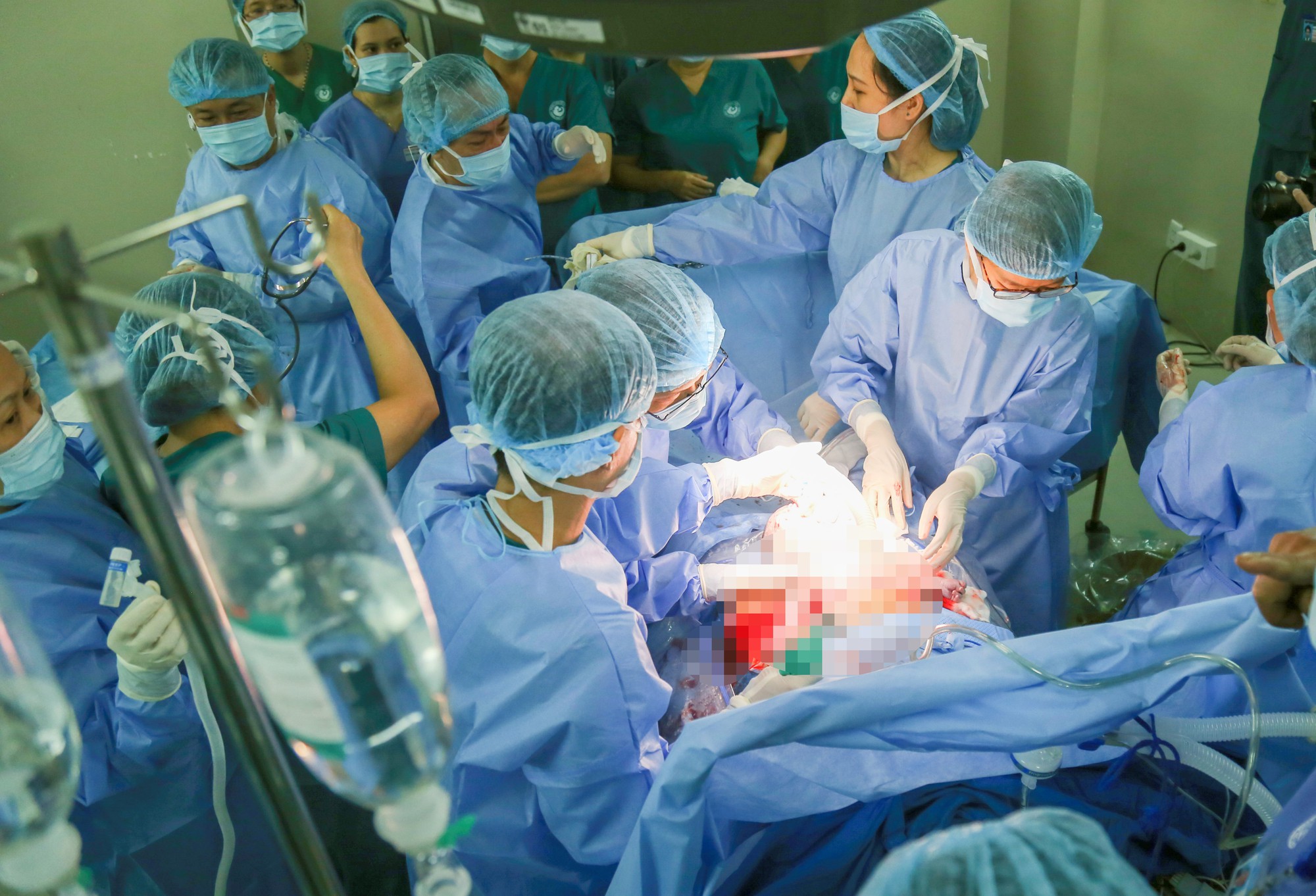 Ngoạn mục làm thủ thuật cứu 2 bé còn nằm một nửa trong bụng mẹ