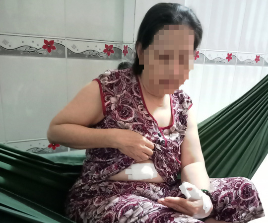 Bình Thuận: Nhóm tín dụng đen chém gần đứt lìa tay con nợ - Ảnh 2.