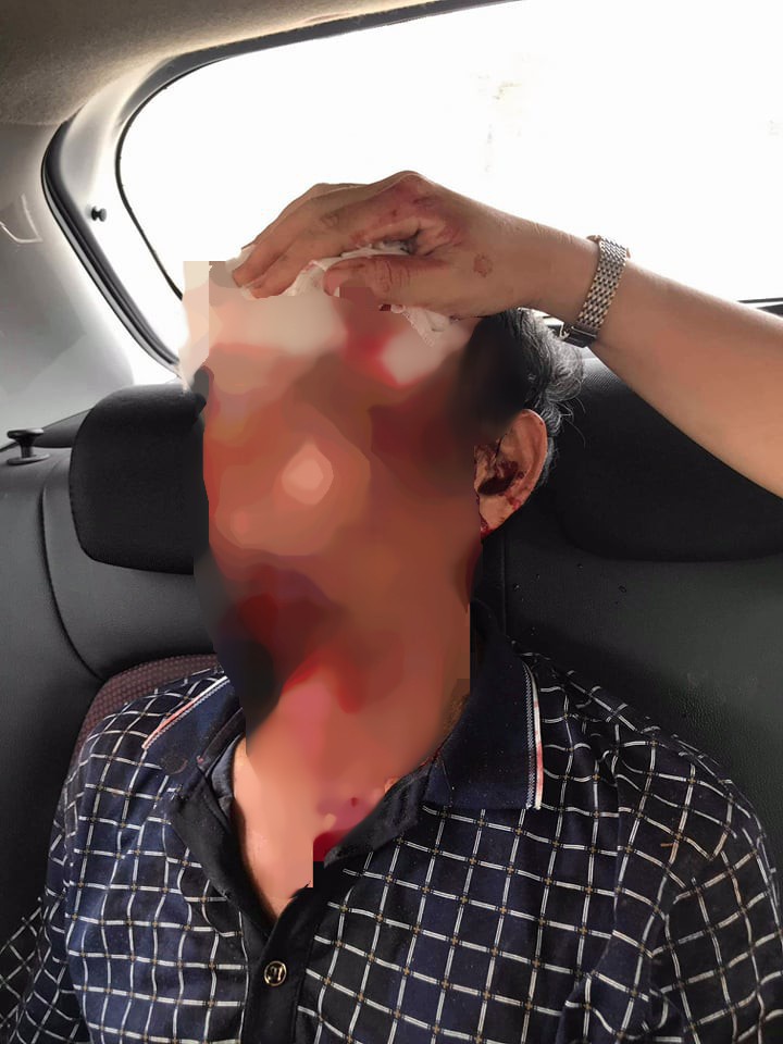 S&uacute;ng nổ vang, 3 người đang ăn cơm bị đạn găm khắp người - Ảnh 1.
