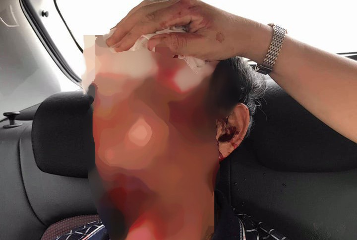 Súng nổ vang, 3 người đang ăn cơm bị đạn găm khắp người