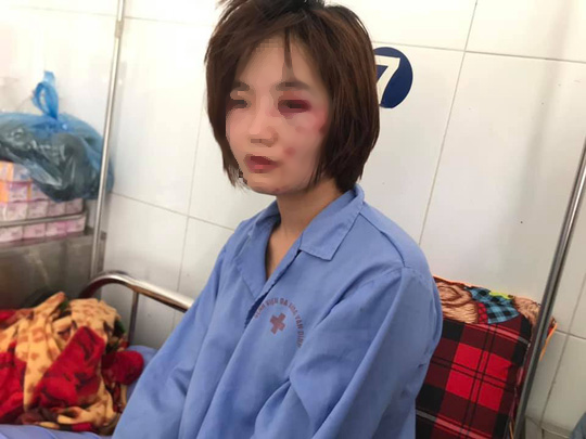 Khởi tố vụ &aacute;n nh&oacute;m thanh ni&ecirc;n xăm trổ đ&aacute;nh hội đồng nữ nh&acirc;n vi&ecirc;n xe bu&yacute;t - Ảnh 2.