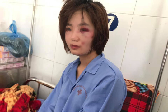 Xác định nhóm thanh niên đánh hội đồng dã man nữ nhân viên xe buýt khi bị nhắc giữ trật tự