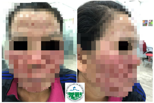 Cược mạng với phẫu thuật thẩm mỹ